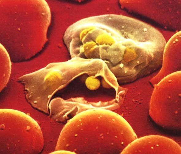the simplest malaria plasmodium parasite