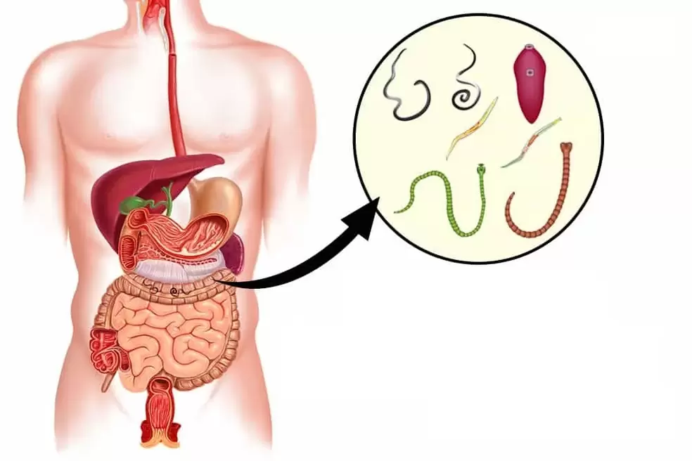 Worms are parasites in the human intestinal tract