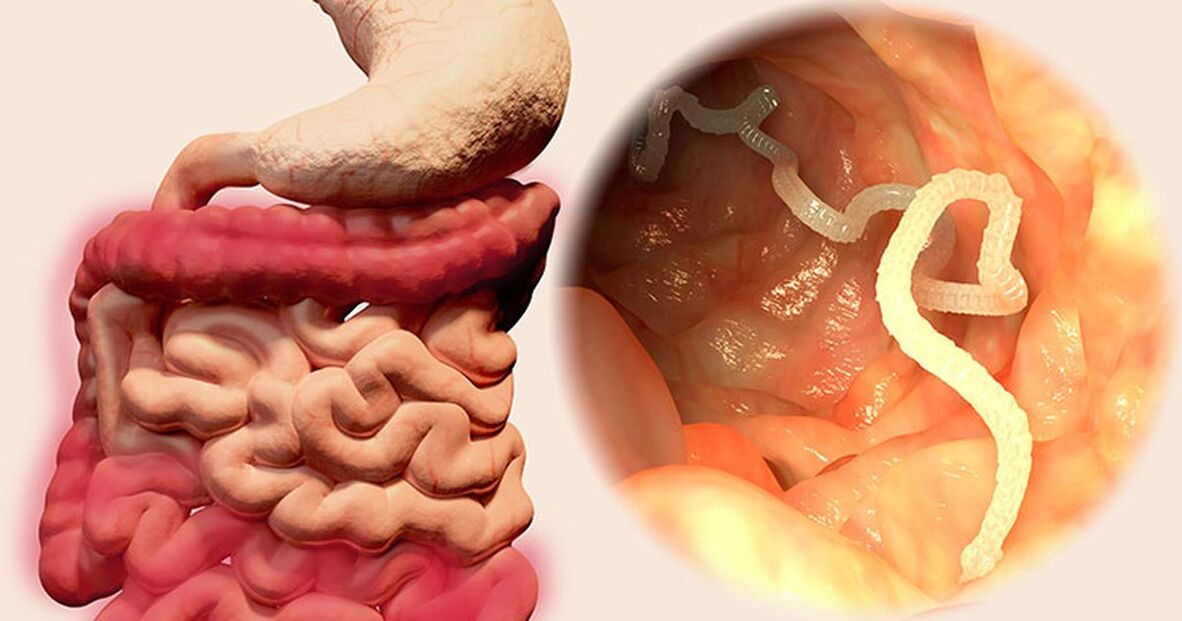 parasites in the human gut