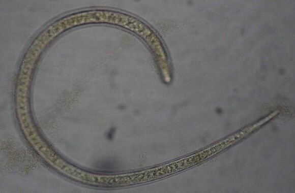 Trichinella is a protostome, round parasitic worm