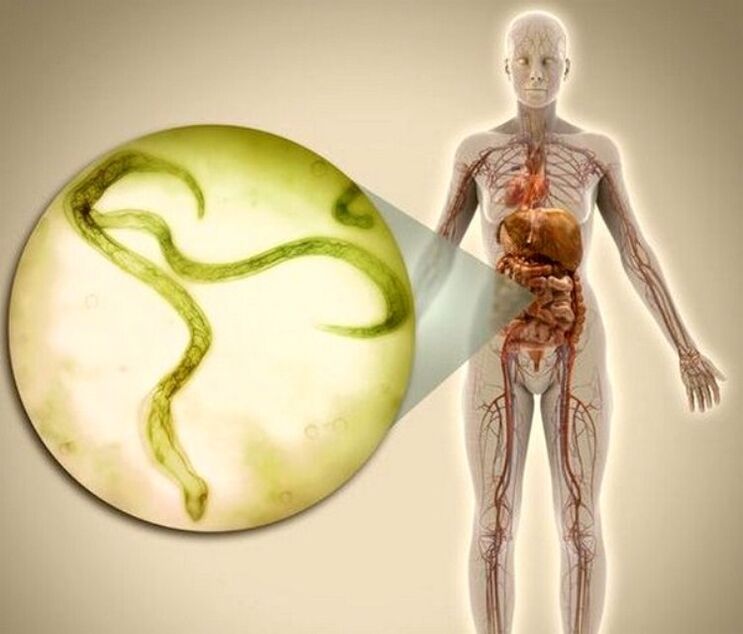 Parasites in the body